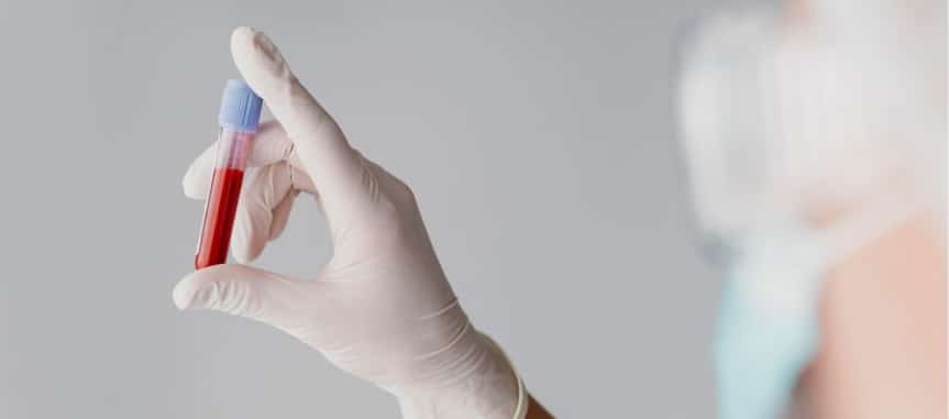 Immunohealth